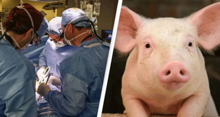 Мужчине пересадили свиную почку — орган проработал в теле человека девять месяцев